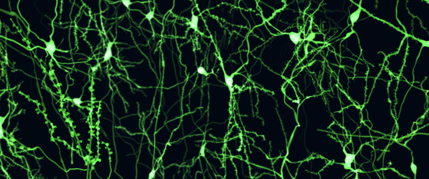 Alterations in Inhibitory Control After Eating Are Seen in Women with History of Bulimia Nervosa
