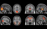 Large Machine-Learning Study Searches for Diagnostic Biomarkers in Major Depressive Disorder