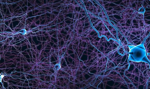 Study Finds Patterns of Brain Atrophy in Schizophrenia Converge on a Common Functional Brain Network